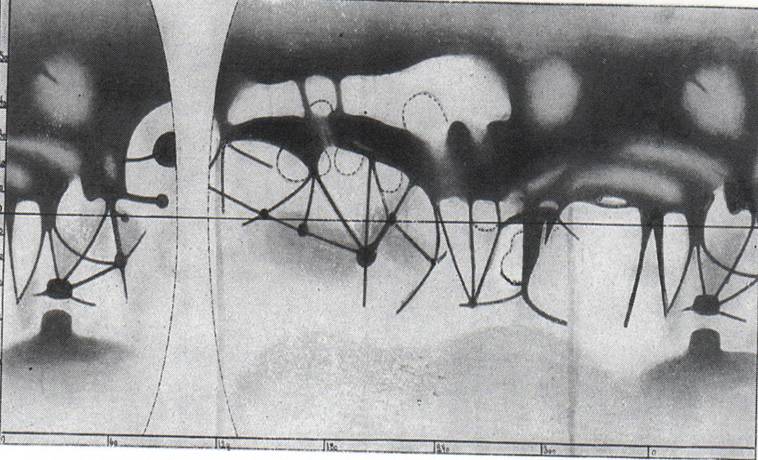 Mars 1911 CLJ EBA